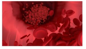 마운자로 위고비 차이